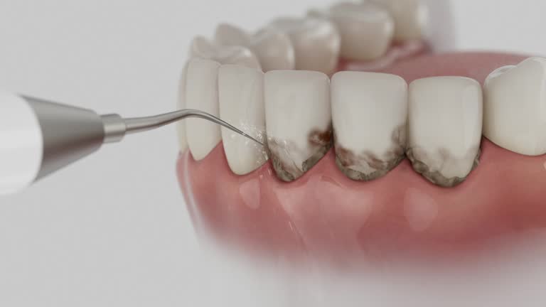 Reliable Wisdom Tooth Removal contractor in McNairy County County, TN by Dentist Open Now